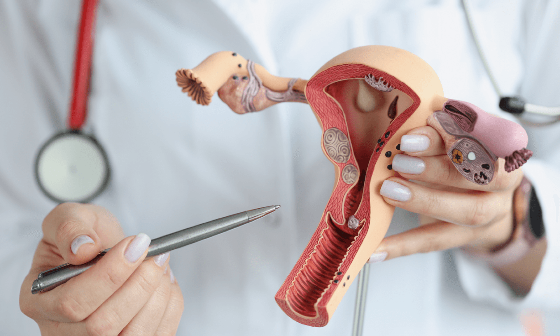 A doctor holding a female reproductive model and pointing at it